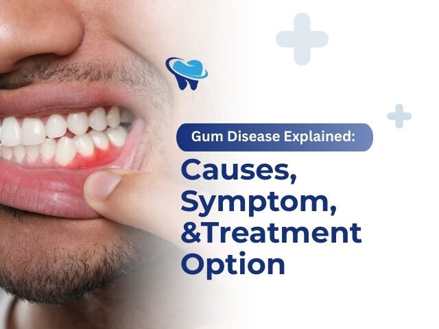 https://uniquedentalclinicfaridabad.com/wp-content/uploads/2025/12/Gum-Disease-Explained-Causes-Symptoms-and-Treatment-Options-640x480.jpg