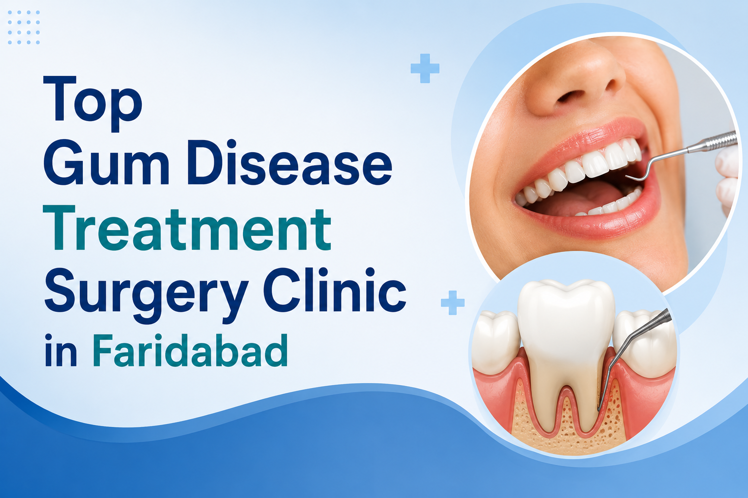 top gum disease treatment in faridabad
