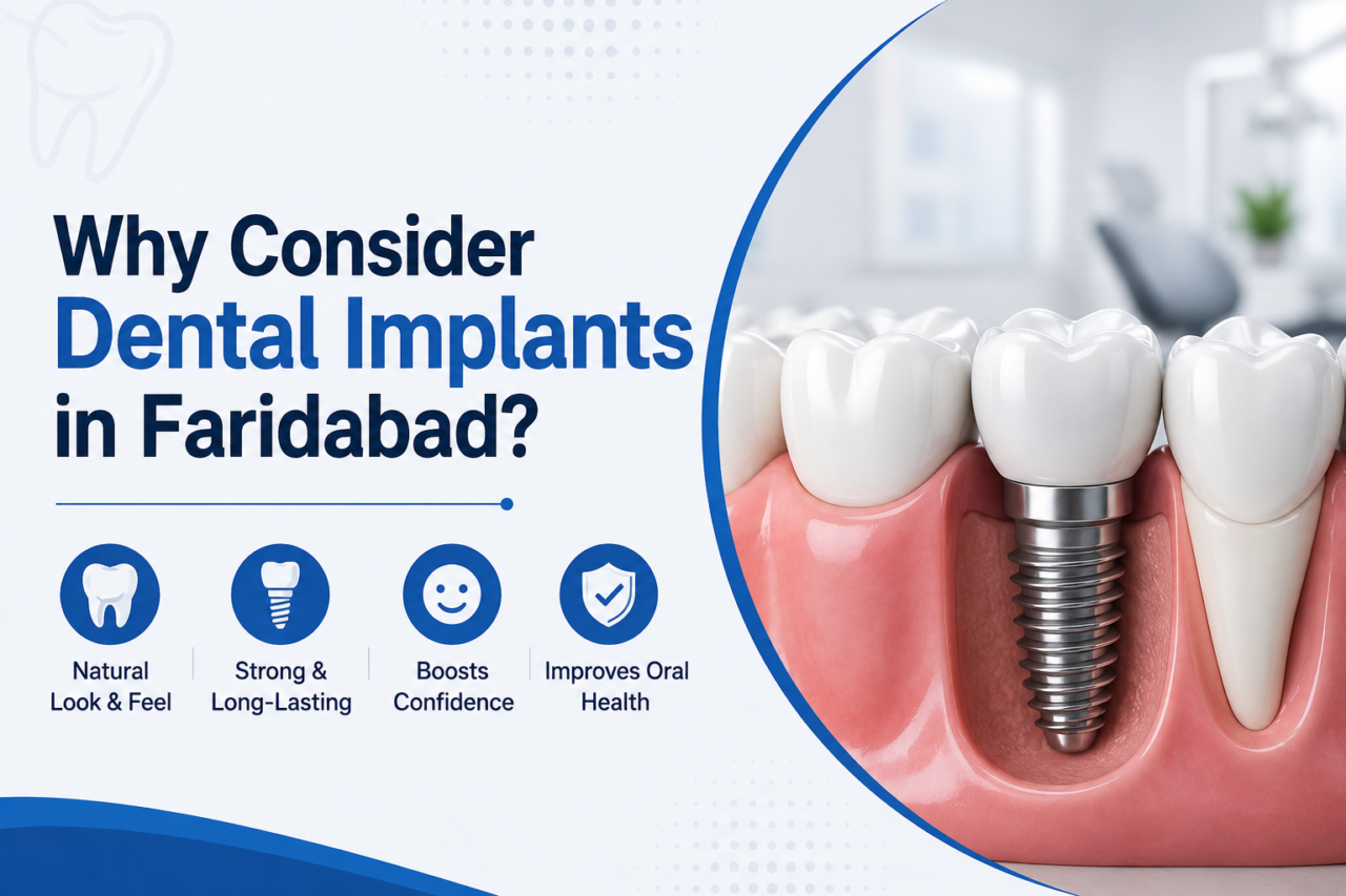 dental implants in faridabad